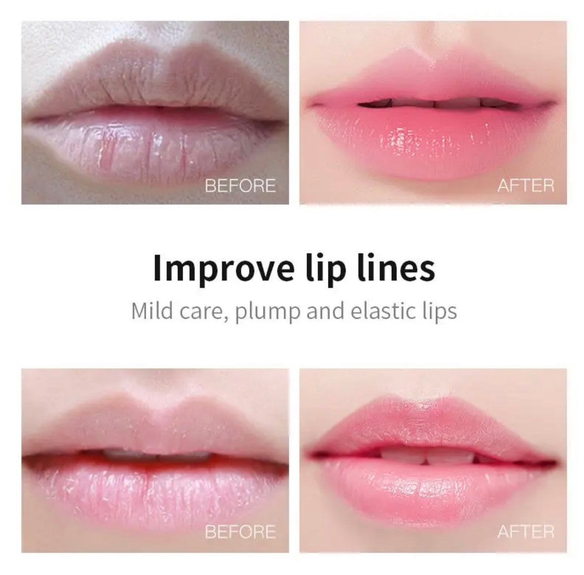 XYBEIBI ,Lips Care Gel Collage